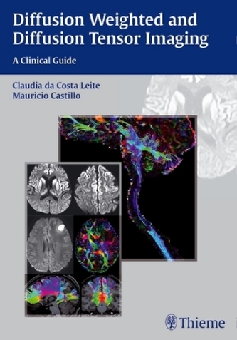 Diffusion Weighted and Diffusion Tensor Imaging